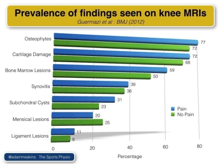 knee mri chart